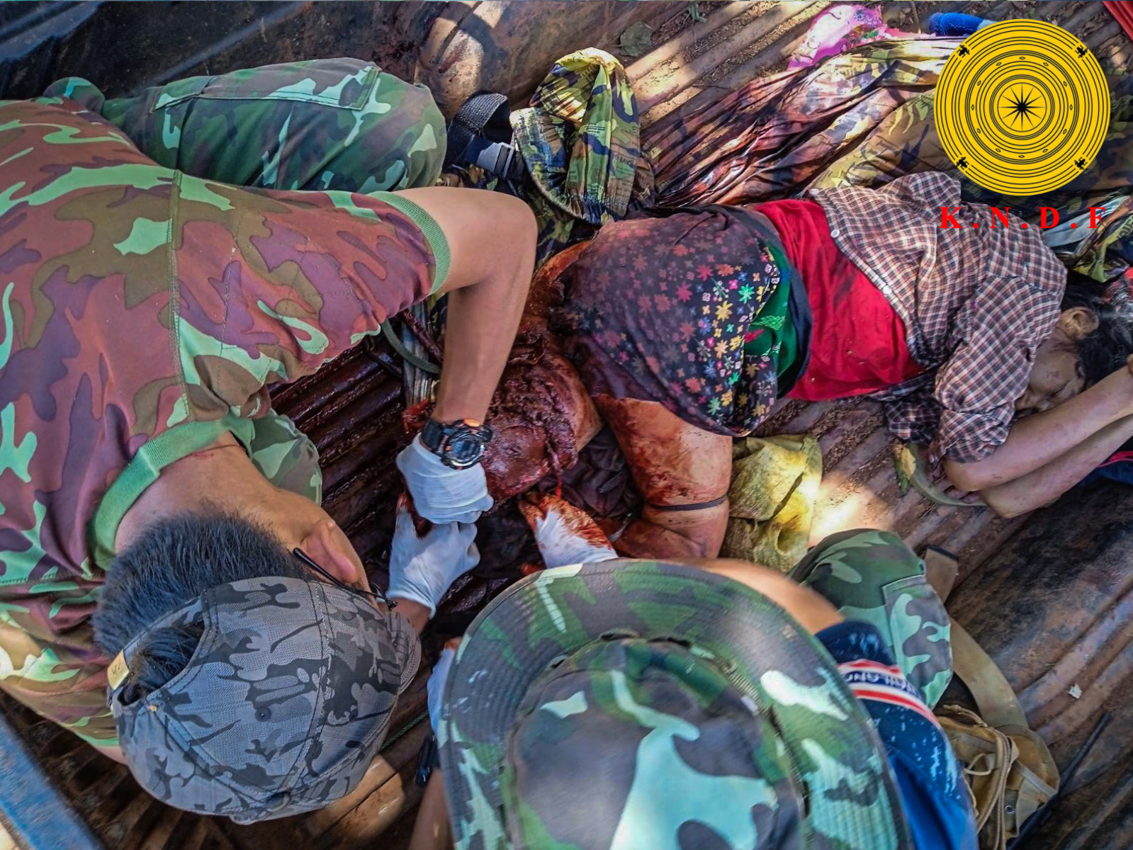 စစ်ကောင်စီမှ တပ်စွဲထားခဲ့သော ကျေးရွာအတွင်း နေအိမ်ပြန်ကြည့်သည့် ဒေသခံ အရပ်သား အမျိုးသမီးတစ်ဦး မိုင်းနင်းမိခြင်း ။